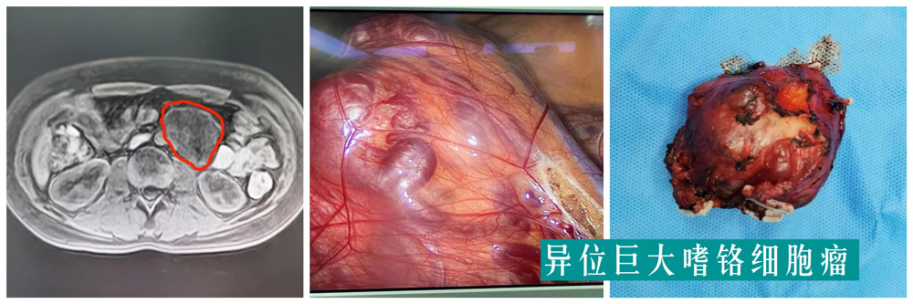 【福德专科】泌尿肾病中心