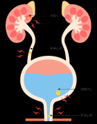  【福德泌尿】结石治疗新选择！一根“软镜”无创碎石！