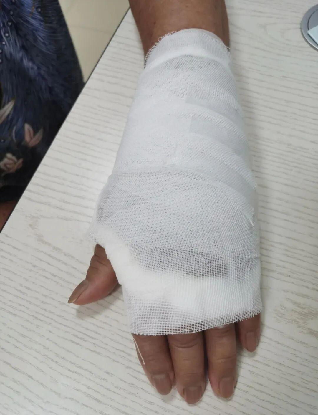 【福德康复】无痛疗愈新选择——中药外敷